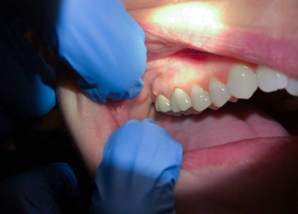 Best Urgent Dental Care for Toothaches in Gman, IL